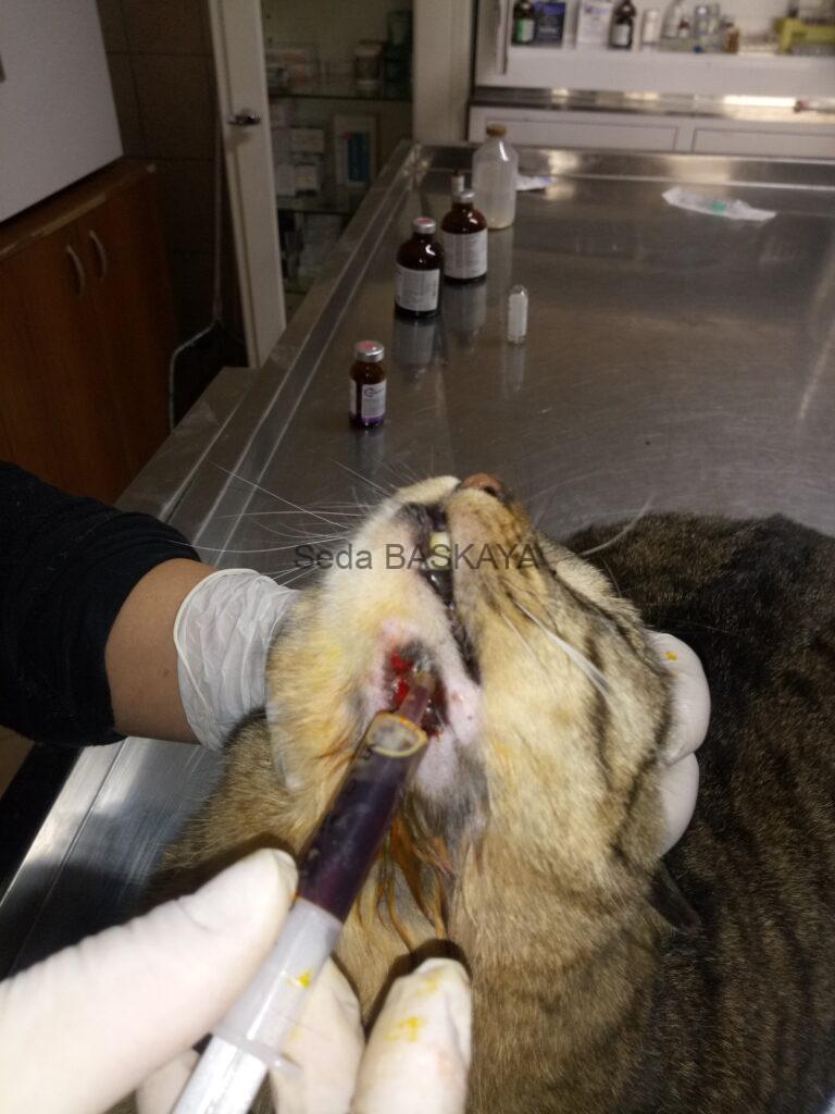 Tooth Infection and Gingivitis