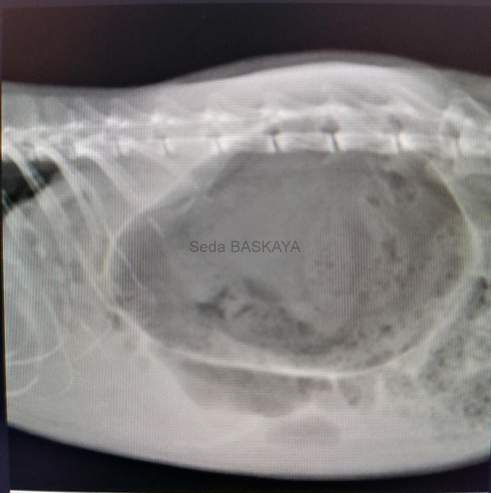 Emergency operation Gastric Volvulus Dilatation